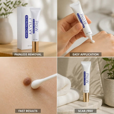 Blemish Cream For Painless Mole And Wart Removal Scar-Free Formula - Image 3