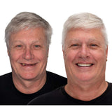 Glue Dentures Full Upper And Lower Set With Fda Registration For Comfort And Security - Image 11