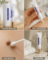 Blemish Cream For Painless Mole And Wart Removal Scar-Free Formula - Image 3
