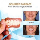 Denture Set Silicone Prothèse Dentaire For Comfortable Dental Replacement - Image 15