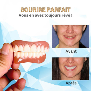 Denture Set Silicone Prothèse Dentaire For Comfortable Dental Replacement - Image 15