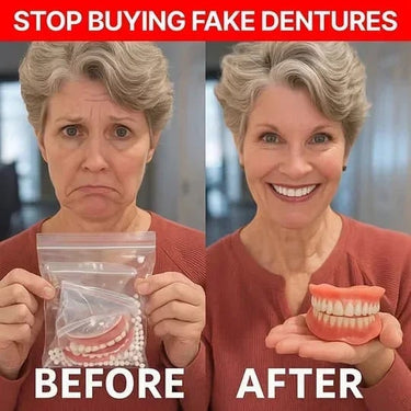 Glue Dentures Full Upper And Lower Set With Fda Registration For Comfort And Security - Image 4